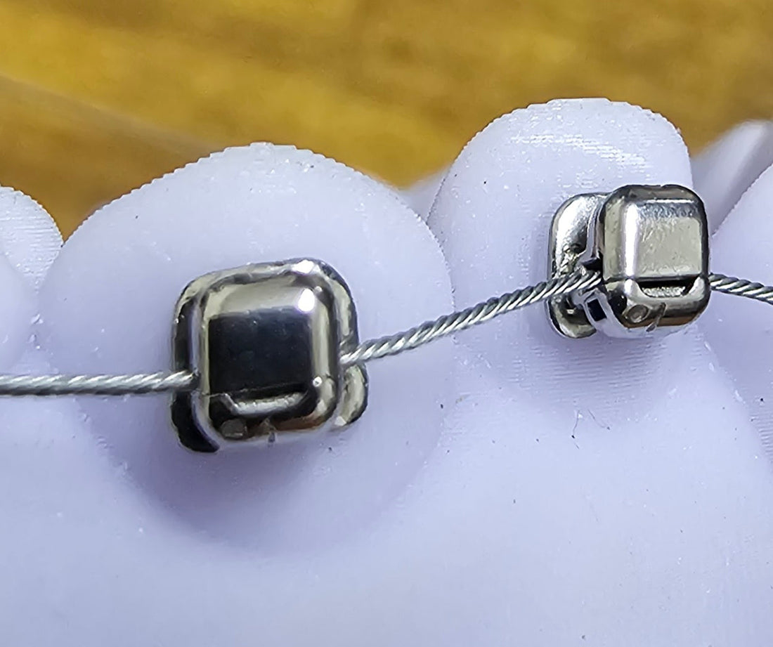 Introducing Dream Smiles Custom Braces: What You Need to Know