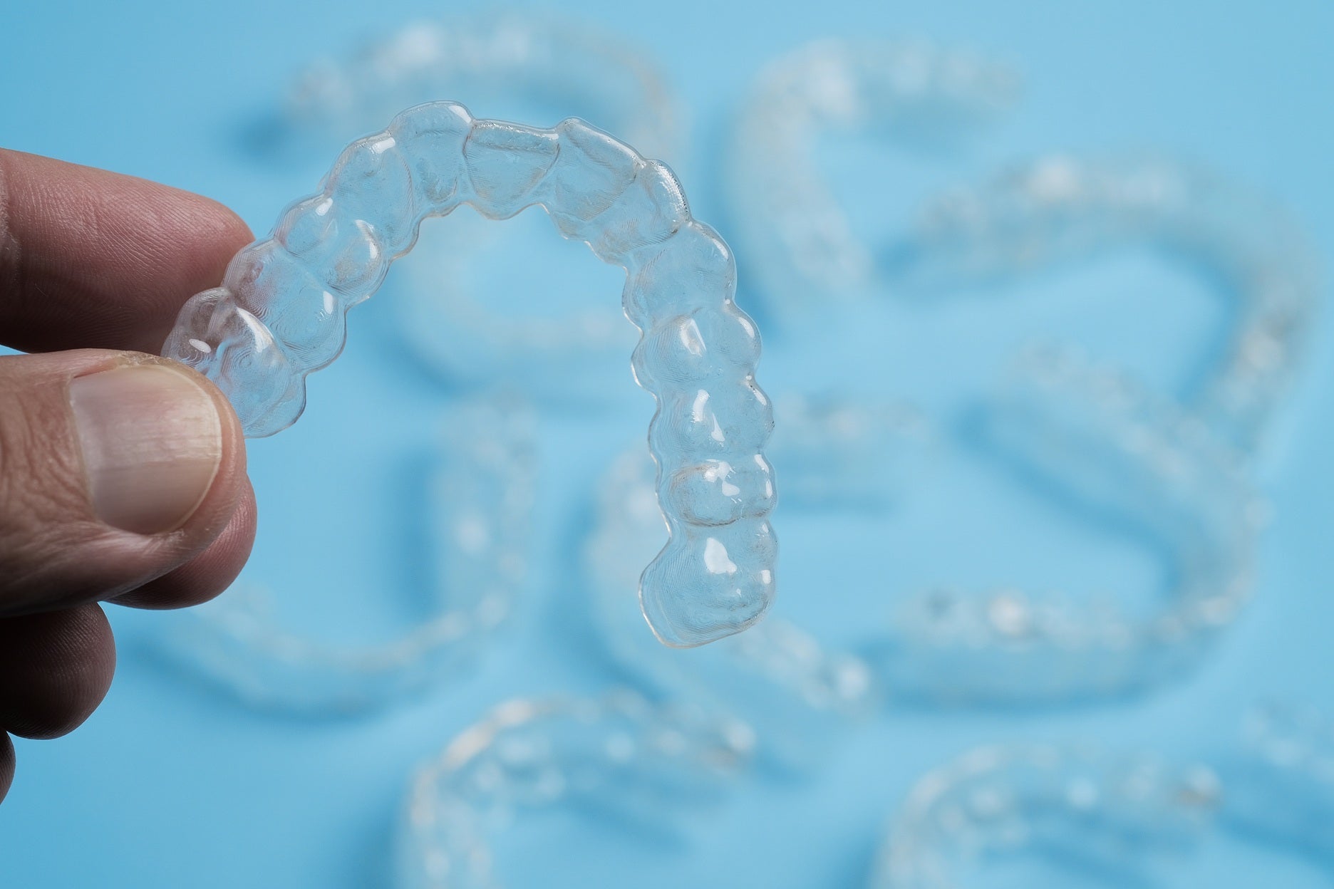 Ordering Clear Aligners Online: A Cost-Effective Route to a Perfect Smile