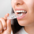 Orthodontic Invisible Clear Aligners Treatment