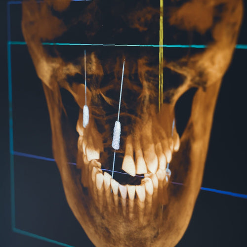 Dental Exam X-ray and CBCT