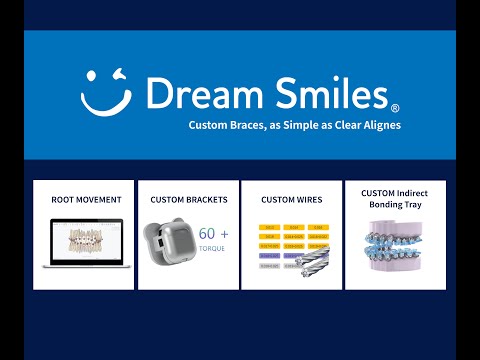 Orthodontic Custom Braces Treatment