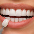 Porcelain Veneers each tooth